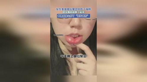 吃蜜瓜嘴唇肿了,嘴唇肿大背后的真相