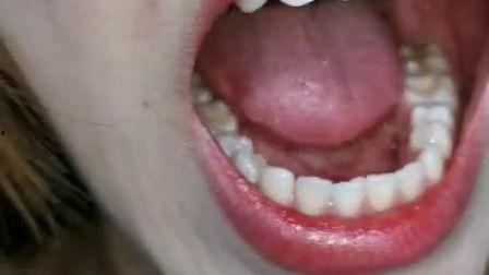 网红MM口腔,美丽笑容的秘密武器